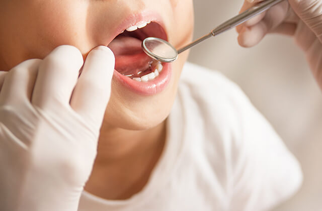 ヘルペス性歯肉口内炎